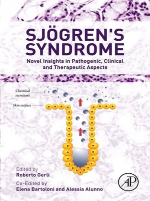 Sjogren's Syndrome - ebook